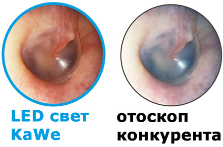 Теплый LED свет отоскопа