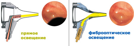 Освещение отоскопа